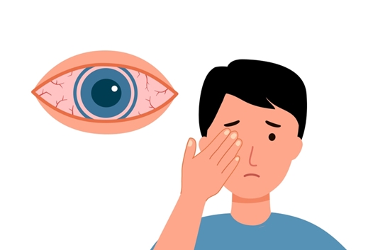 چرا چشمان ما قرمز می‌شوند و چه زمانی باید به پزشک مراجعه کنیم؟ 